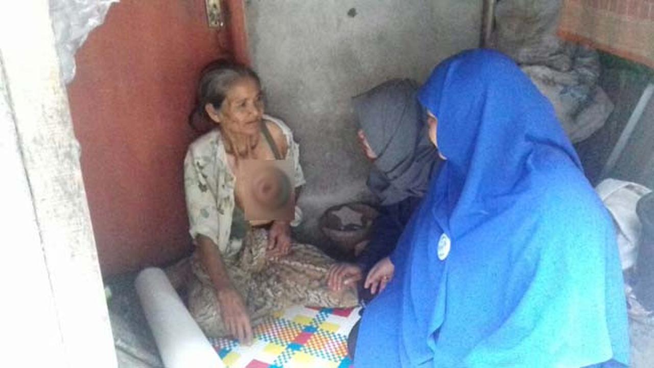 Nenek Rami, Sebatang Kara Hadapi Derita Kanker Payudaranya