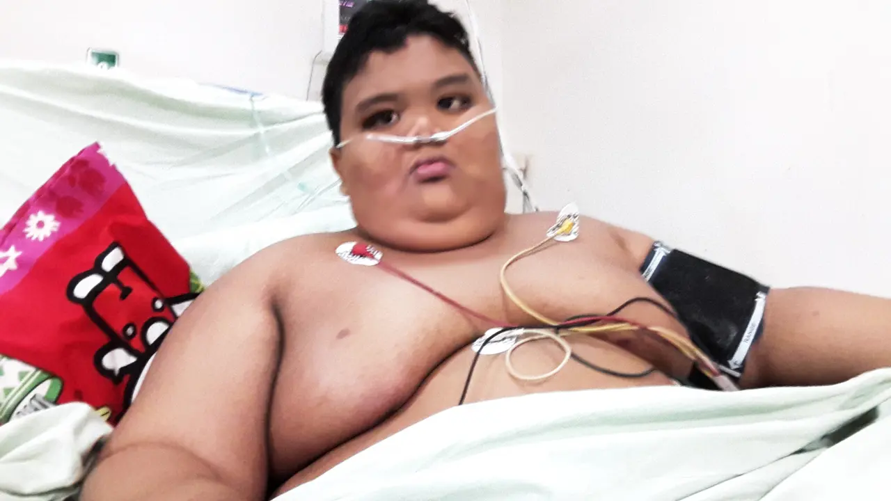 Bocah Obesitas asal Palembang