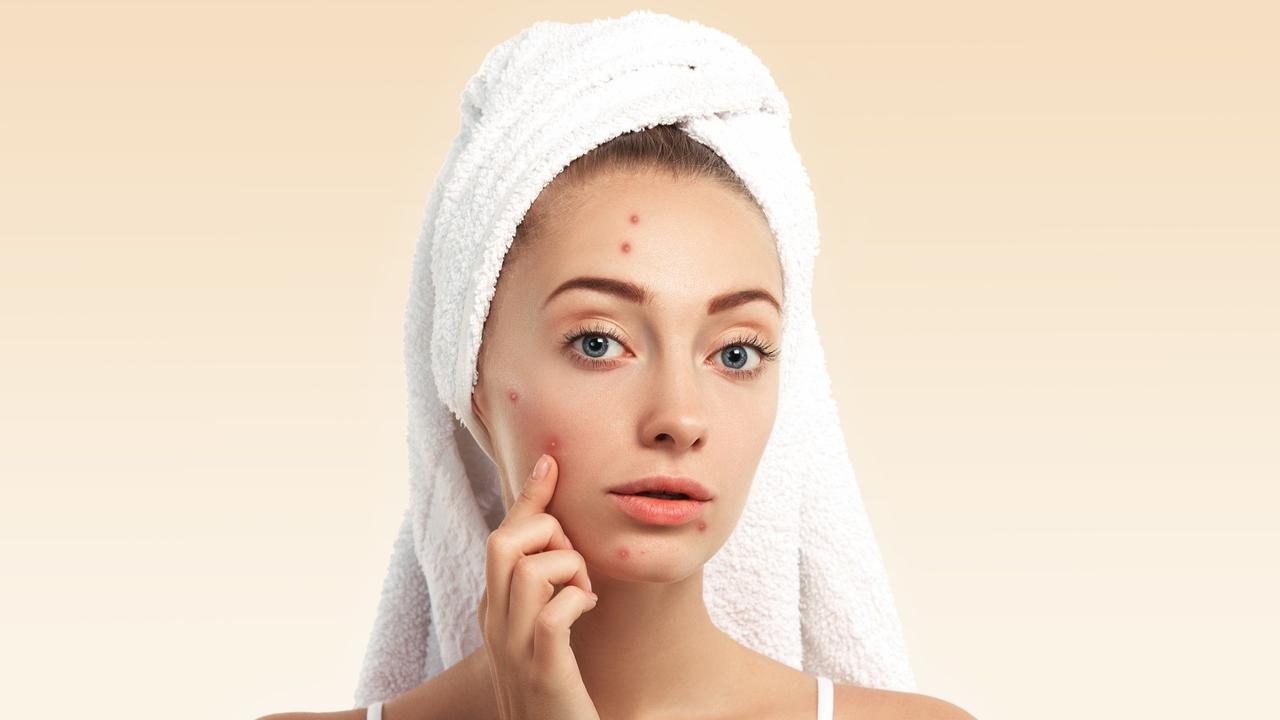 Pimple
