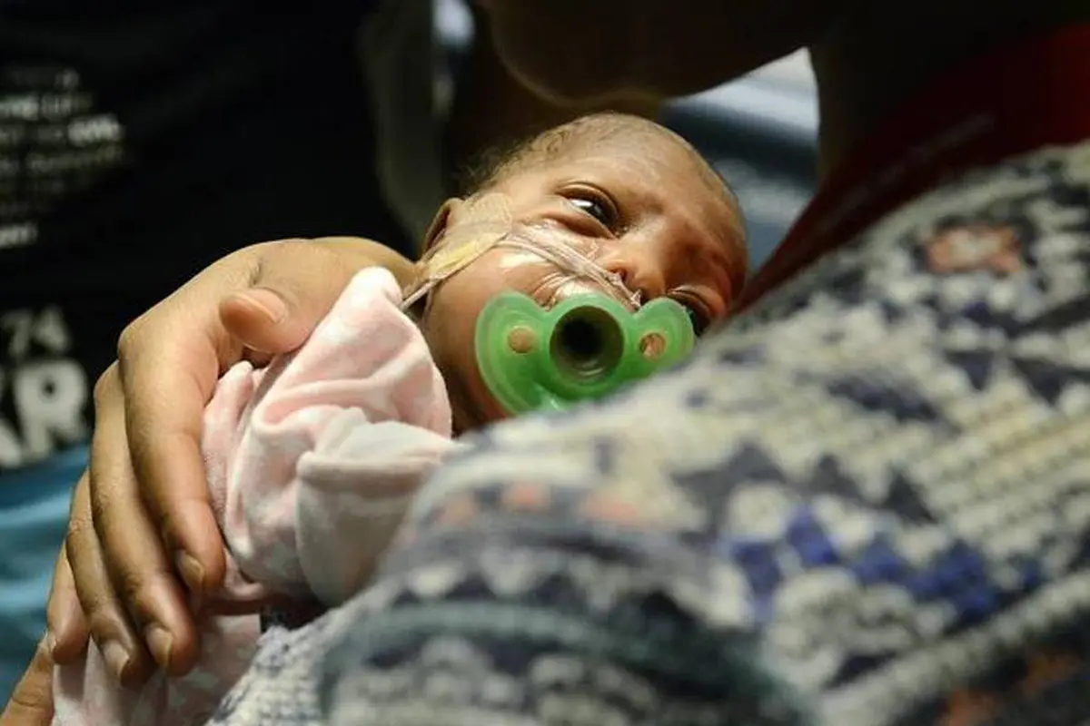 Berat Tubuh Tak Sampai 1 kg, Bayi Ini Tetap Berjuang Hidup