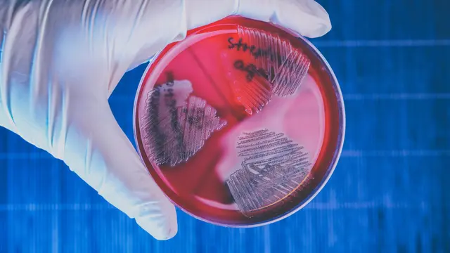 Bakteri Streptococcus