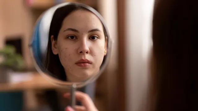 Air Keran Bikin Jerawat? Ini Dia 6 Masalah Kulit yang Bisa Muncul Akibat Air yang Tidak Cocok! (Foto: Freepik/freepik)