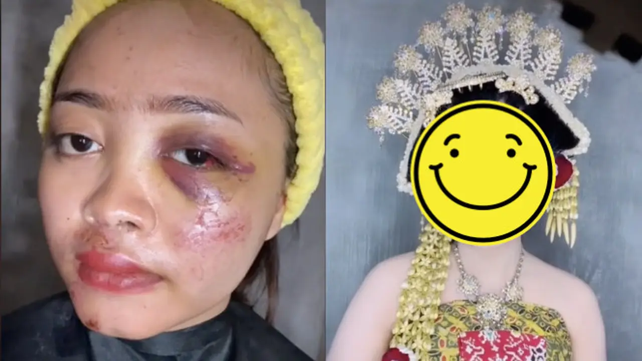 Alami Kecelakaan Jelang Hari Pernikahan, Hasil Rias Pengantin Ini Bikin Pangling
