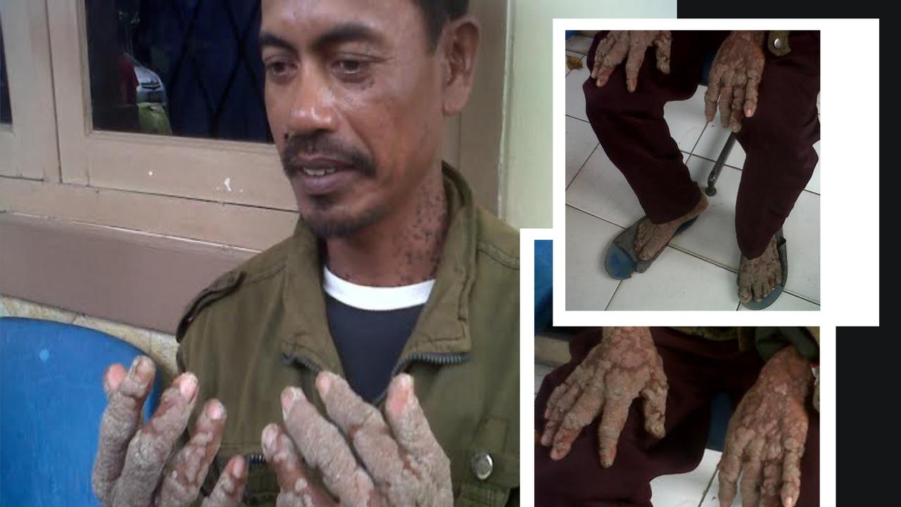 Manusia Akar Ditemukan di Banten