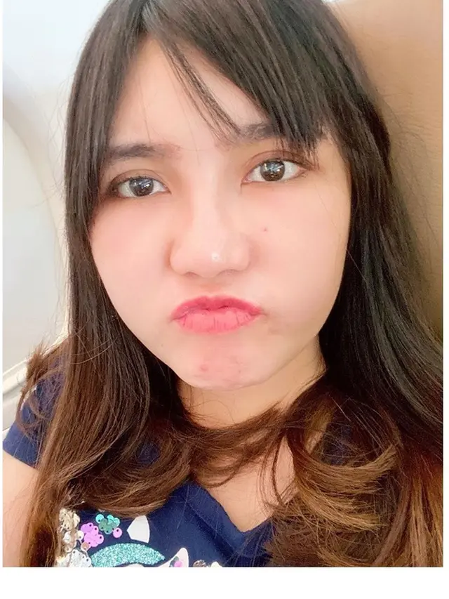 Akui Tengah Perawatan Pipi, Ini 7 Potret Terbaru Via Vallen yang Makin Chubby