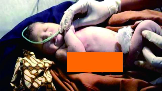 Bayi menderita luka tusuk di perut sebelah kanan sampai ussnya keluar. Korban juga menderita luka cakaran di punggung dan dada. (Foto: Liputan6.com/Muhamad Ridlo/Polres Banyumas)