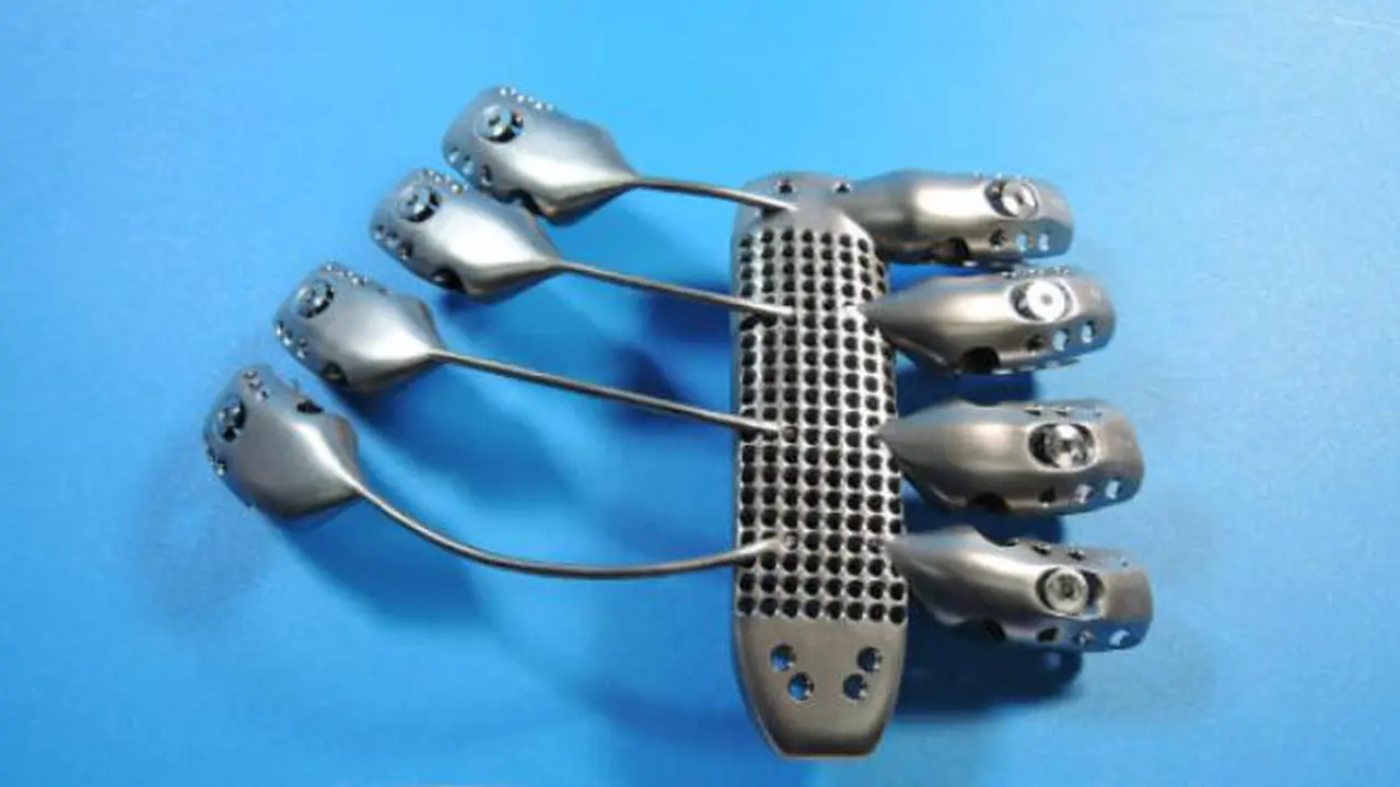 Implan berbahan titanium hasil cetak 3D printer