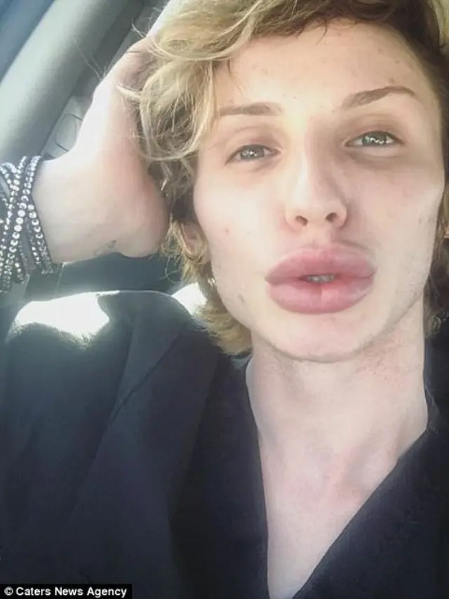 [Bintang] Demi Mirip Kylie Jenner, Transgender Ini Rela Jalani 40 Operasi Plastik