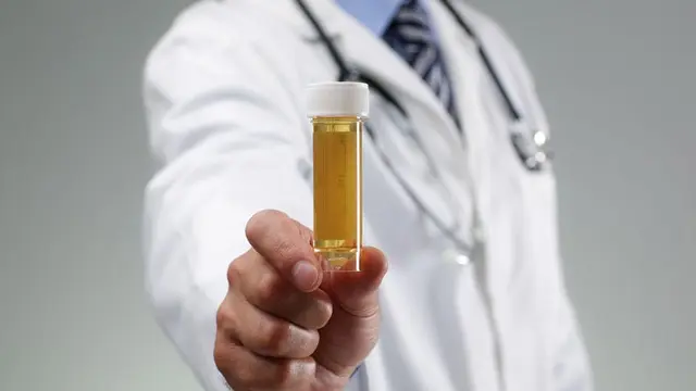 Ilustrasi Urine