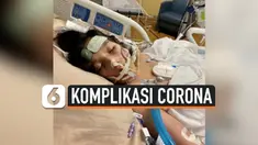 komplikasi corona