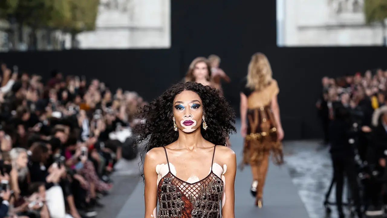 Winnie Harlow di Panggung Paris Fashion Week