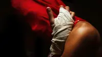 Main Petasan Jelang Buka Puasa, Dua Bocah di Mesuji Alami Luka Bakar Serius