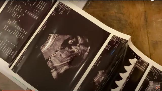 Baim Wong dan Paula Verhoeven Ungkap Jenis Kelamin Anak Kedua