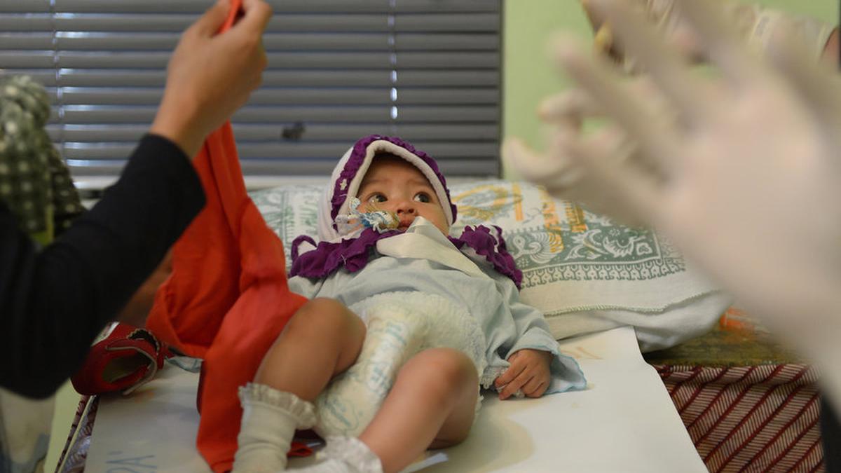 Ragam Pendapat Ulama tentang Hukum Khitan Bagi Perempuan