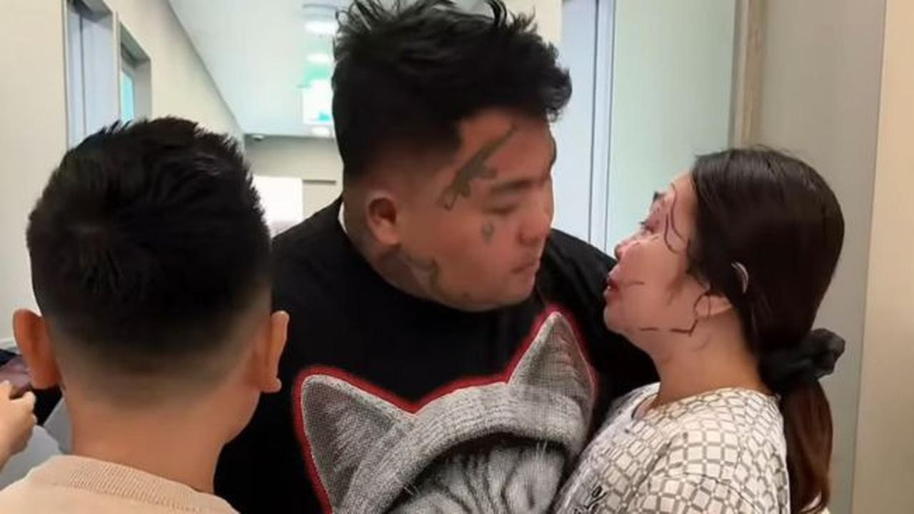 King Abdi ungkap perjalanan istri jalani oplas di Korea. (credit:instagram.com/kingabdi_jajanmercon/newvelle.solutions/indriani.dina)