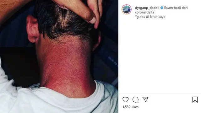 Dyrga Dadali (Foto: Instagram/@dyrganp_dadali)