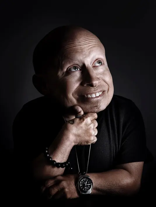 Kabar duka itu disampaikan keluarga sang aktor melalui akun Instagram pribadinya. "Dengan kesedihan mendalam, kami mengabarkan jika Verne meninggal dunia pada hari ini," ujar pihak keluarga melalui keterangan tertulis. (Foto: instagram.com/vernetroyer)