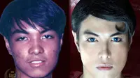 Seorang pria asal Filipina terobsesi menjadi serupa dengan tokoh Superman. Ia pun memutuskan untuk melakukan operasi plastik (sumber. Elitereaders.com) 