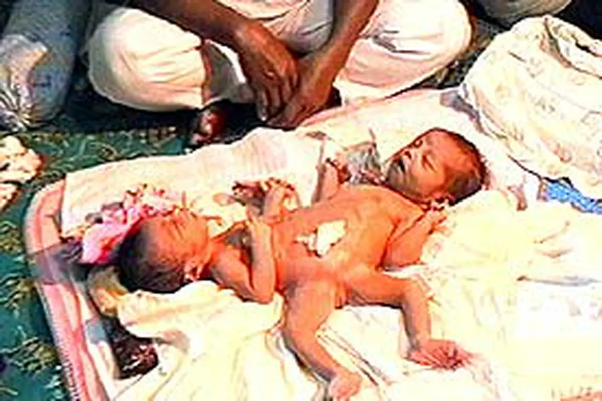 200204aKembarBayi.jpg