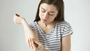 Apakah ke Dokter Kulit Bisa Pakai BPJS? Ini Aturan dan Cara Berobatnya