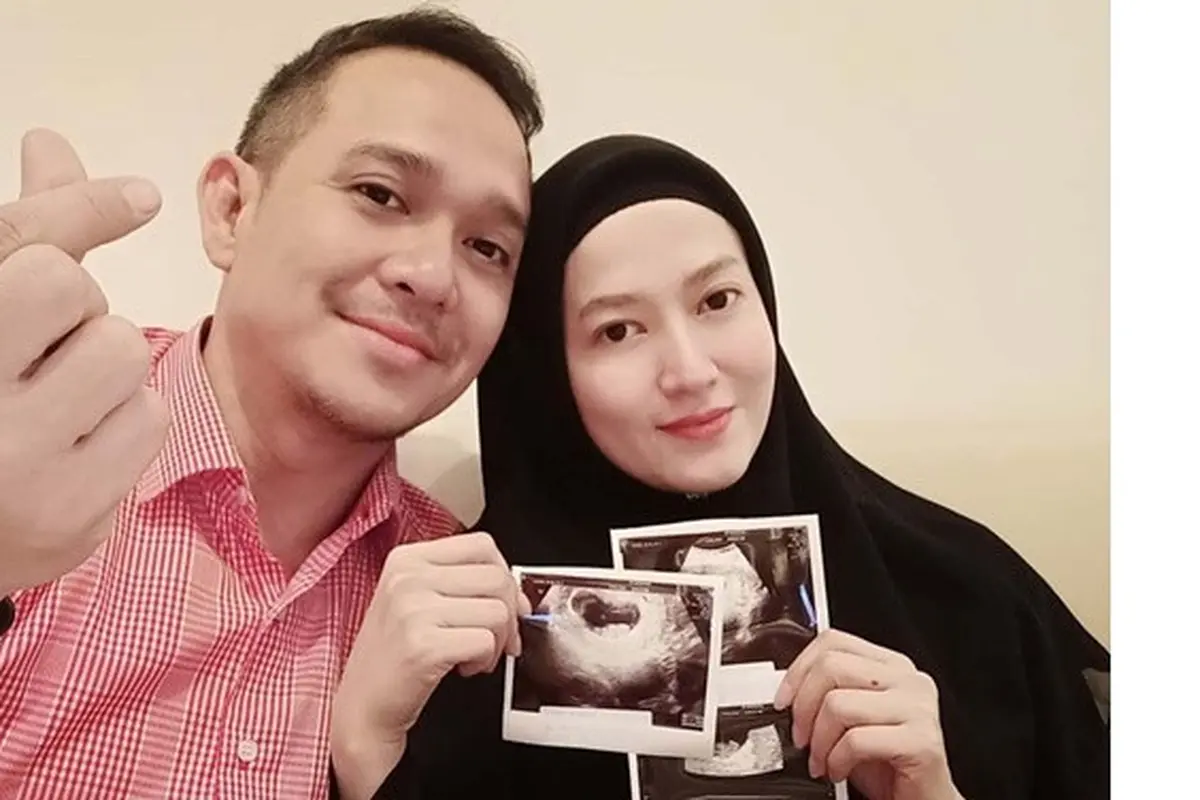 Hamil Setelah 7 Tahun Nikah, Ini 6 Potret Lyra Virna Pamer Perut Buncit
