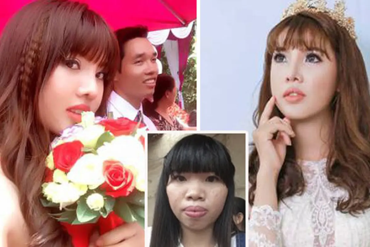 Bosan Dibully, Gadis Ini Bermetamorfosis Jadi Bidadari 