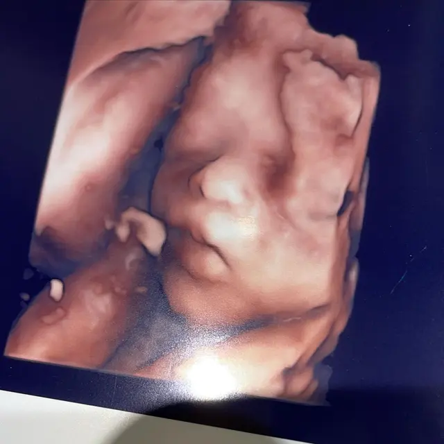 [Fimela] Nathalie Holscher