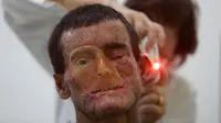 Teka-teki Penyakit Langka yang Menyerang Warga Desa di Brasil