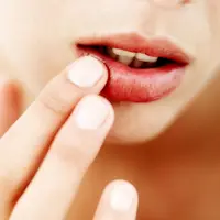 Dengan beberapa cara sederhana ini kamu bisa mengatasi bibir pecah-pecah yang buat penampilan kamu tidak maksimal.
