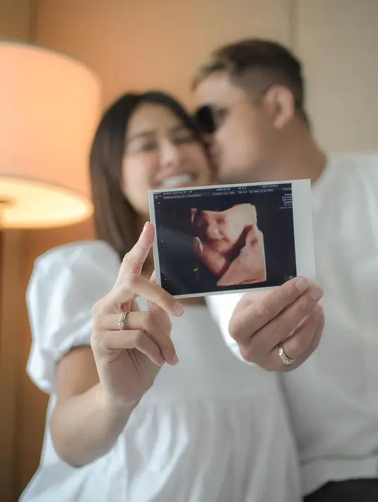 Bunga Jelitha Hamil Pertama (Instagram/bungajelitha66)