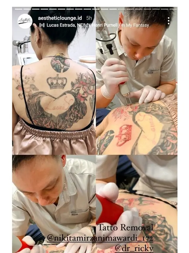 Tak Akui Anak, Ini 7 Potret Nikita Mirzani Hapus Tato Nama Lolly di Punggung