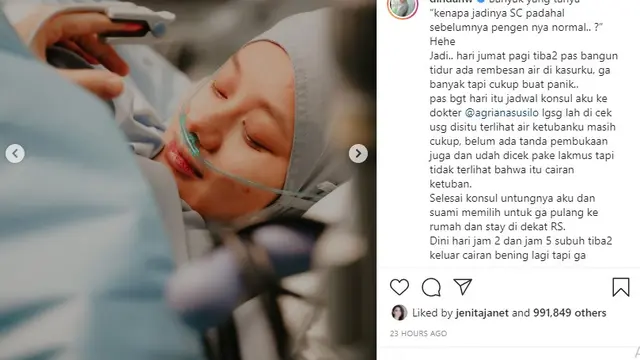 Dinda Hauw (Foto: Instagram/@dindahw)