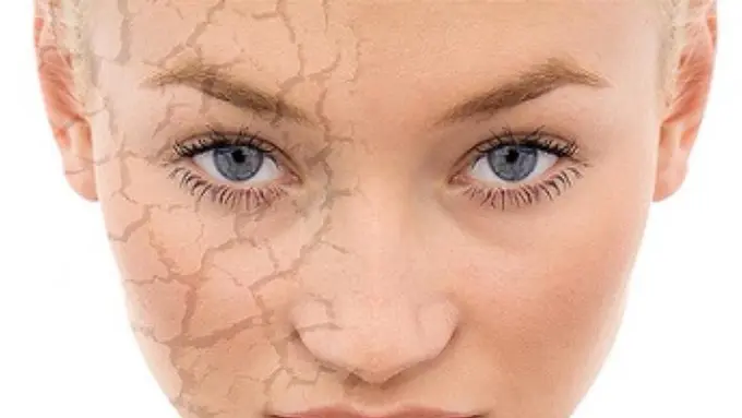 Ini Cara Ampuh Mengatasi Kulit Kering dan Bersisik