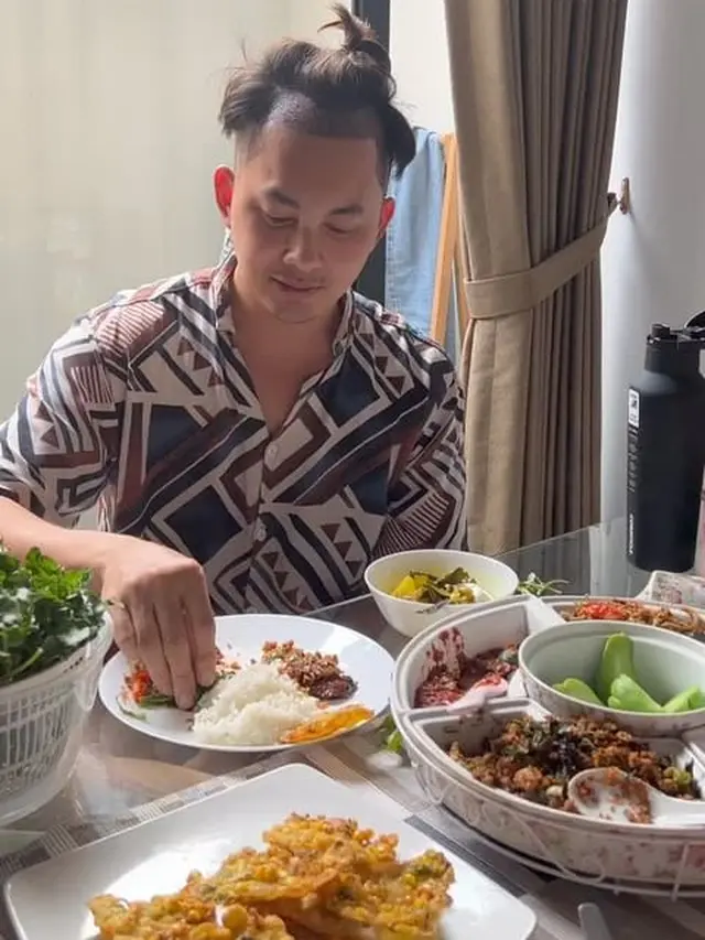7 Potret Kiki Farel Transplantasi Rambut, Seru Nikmati Liburan Sebelum Operasi