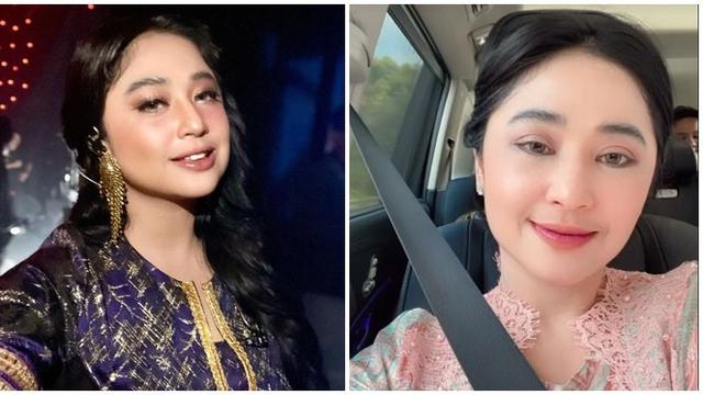 6 Potret Beda Penampilan Dewi Perssik Sebelum vs Setelah Operasi Transfer Lemak