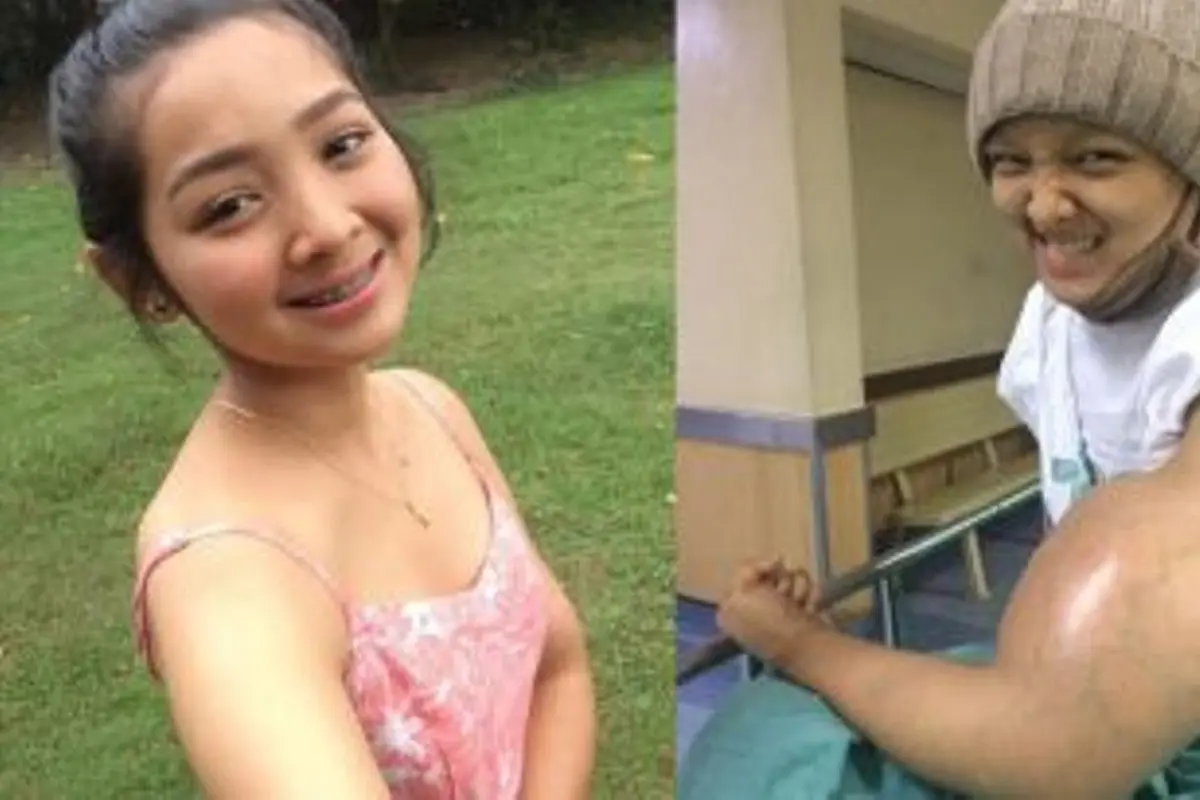 [Bintang] Satu Tangan Diamputasi karena Kanker, Gadis Cantik Ini Berbagi Kisah Hidupnya di Media Sosial