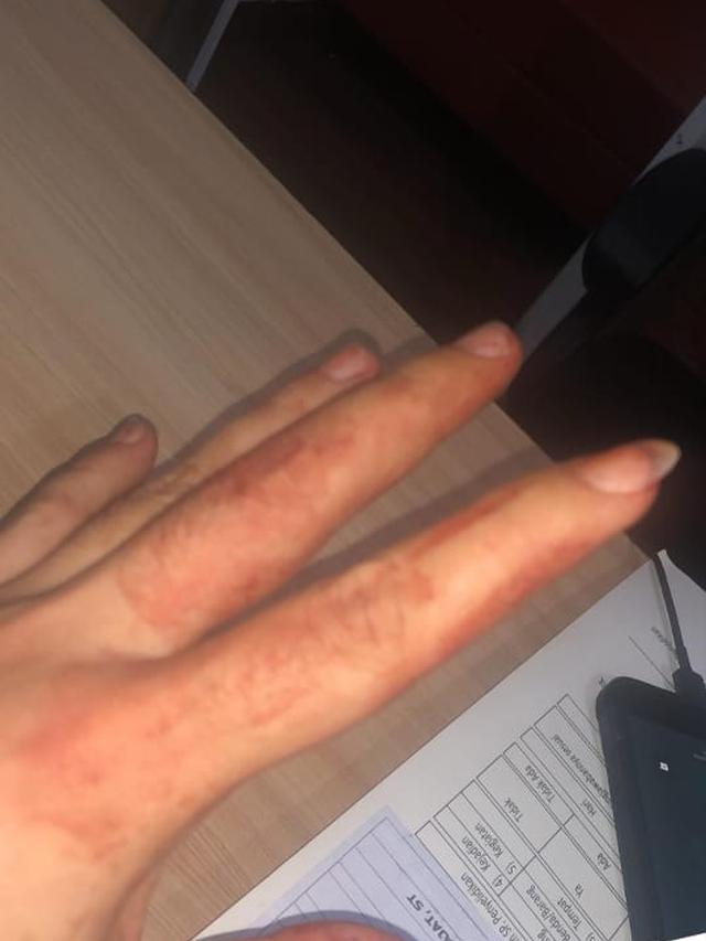 Unggahan korban Pemukulan Kriss Hatta