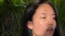 Asha Assuncao merupakan salah satu artis yang percaya diri pamer wajahnya yang berjerawat. Berfoto saat golden hour, wajah natural Asha Assuncao semakin terlihat jelas, bahkan pori-porinya. Selfie atau berfoto saat golden hour ini memang tengah menjadi tren foto yang cukup populer untuk pamer wajah, apalagi ketika sedang tampil tanpa makeup. (Liputan6.com/IG/@asha.assuncao)