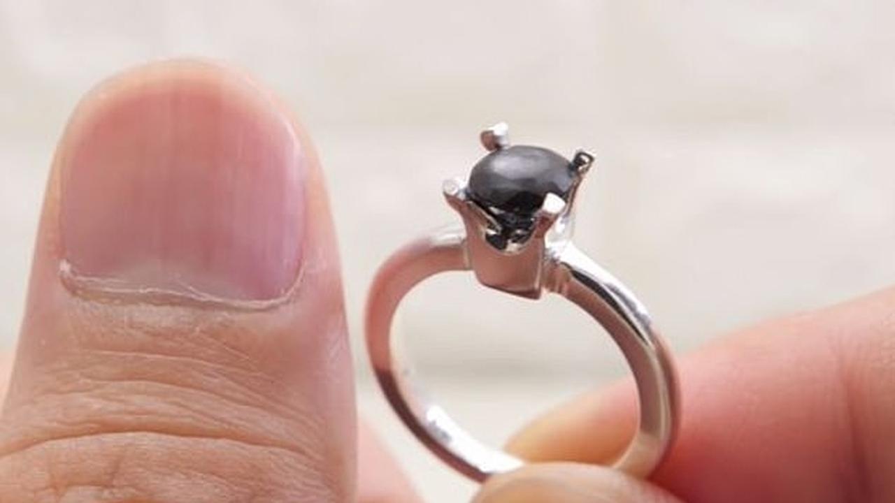 Ingin Lamar Kekasih, Pria Ini Buat Cincin Pertunangan Dari Bagian Tubuhnya