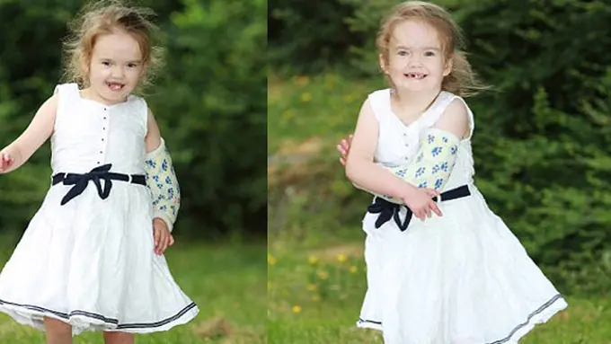 (C) Worldwidefeatures.com