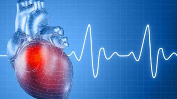 Penyakit jantung koroner merupakan penyakit utama yang disebabkan oleh kolesterol tinggi.