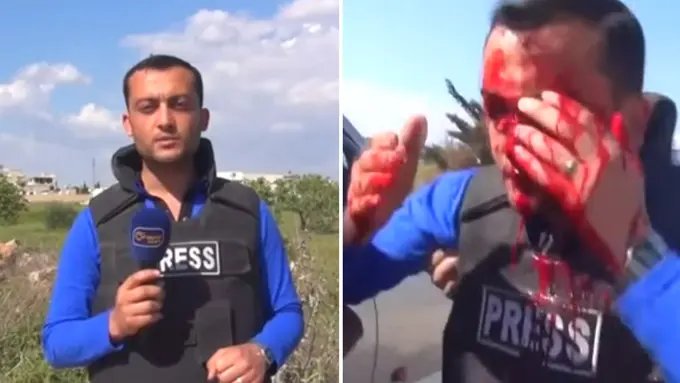 Ngeri! Wajah 'Reporter' TV Ini Terkena Pecahan Peluru Meriam