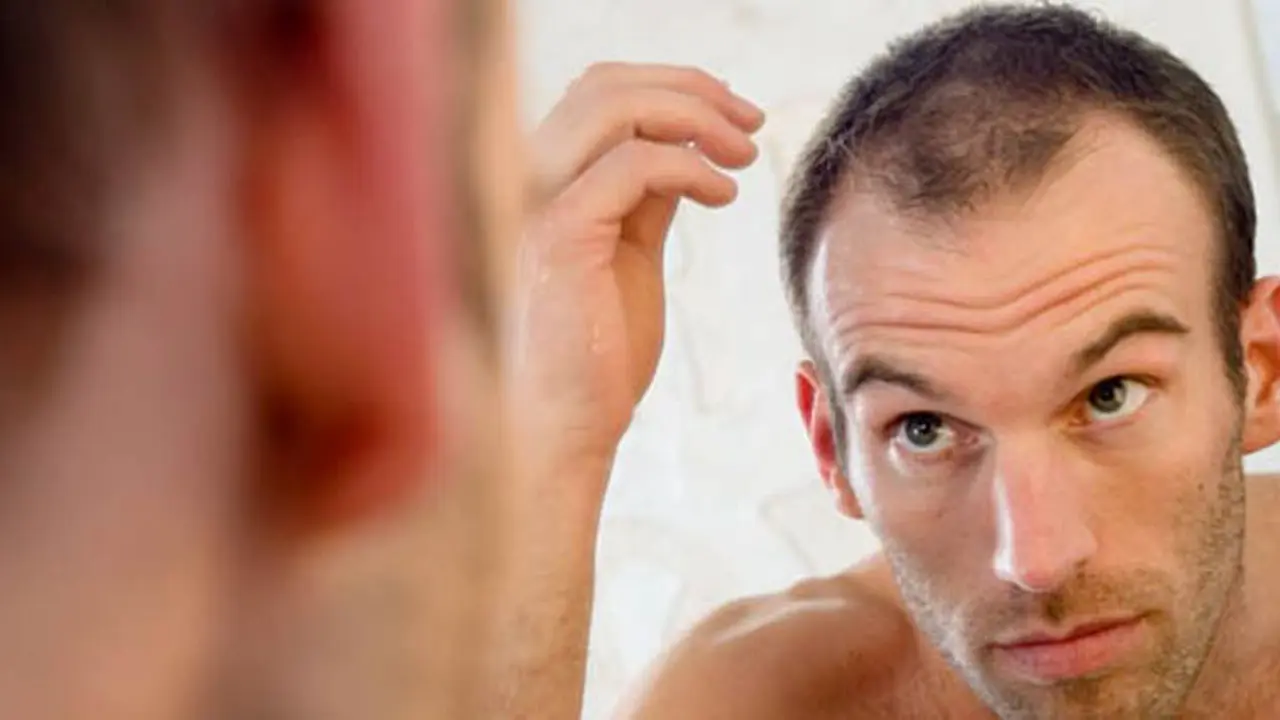 rambut-rontok-140208b.jpg