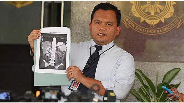 Polisi terus mendalami kasus dugaan penjualan organ tubuh yang terjadi di Jawa Barat. Saat ini ada 3 dokter dari salah satu rumah sakit di Jakarta yang diperiksa penyidik.