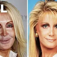 Mereka adalah korban operasi plastik gagal.