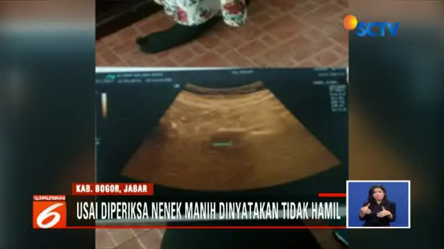 Dinas Kesehatan Bogor Bantah Kehamilan Nenek Manih