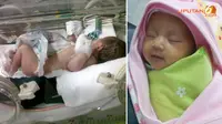Berkat Kebaikan RS Medistra Bayi Cantika Boleh Pulang