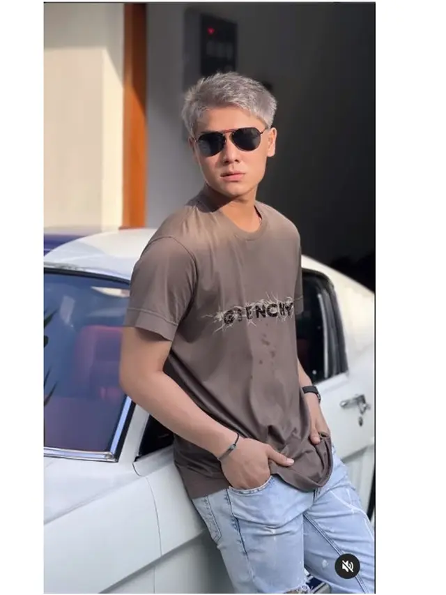 Ubah Warna Rambut, Ini 6 Potret Terbaru Rizky Billar Disebut Makin Kece