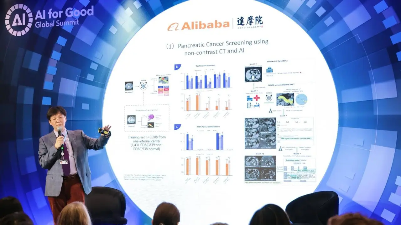 Lembaga riset Alibaba, DAMO Academy menggunakan teknologi artificial intilligence (AI) dalam mengembangkan alat untuk mendeteksi kanker. (Dok Alibaba)