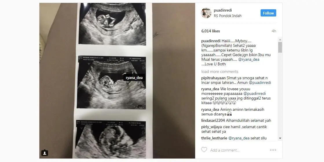 Ryana Dea hamil anak pertama [foto: instagram/puadinredi]